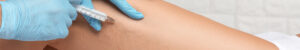 Hautarztpraxis derma-Praxis-Vest Leistungen Ästhetische Beratung