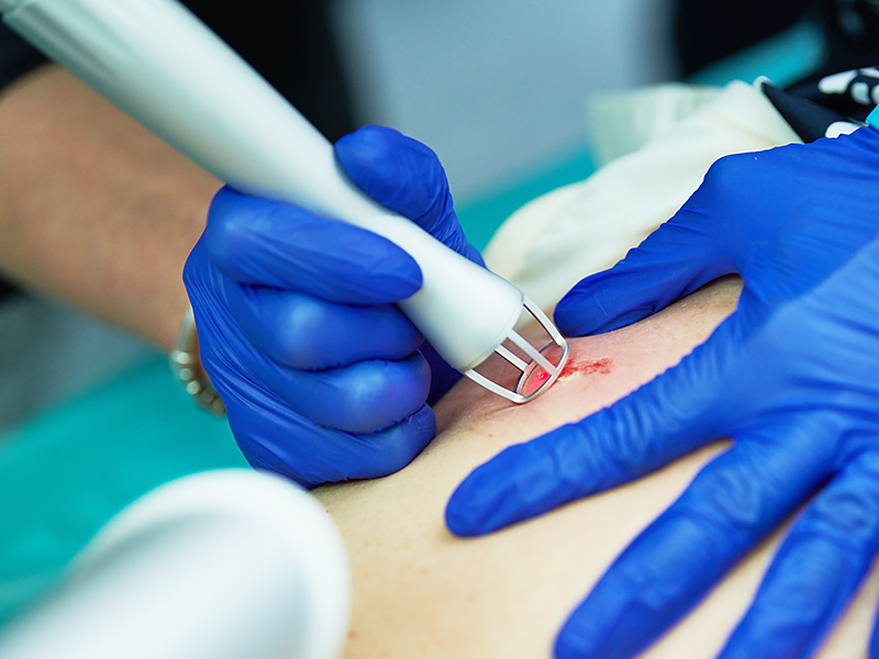 derma-Praxis Vest Hautarztpraxis Ambulante Eingriffe