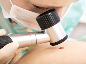 derma-Praxis Vest Hautarztpraxis Hautkrebsvorsorge